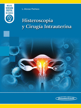 HISTEROSCOPIA Y CIRUGA INTRAUTERINA